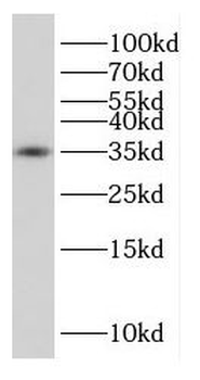 MAPRE1 Rabbit Polyclonal Antibody