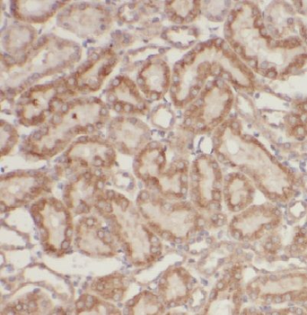 MAPRE1 Rabbit Polyclonal Antibody