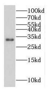 MAPRE3 Rabbit Polyclonal Antibody