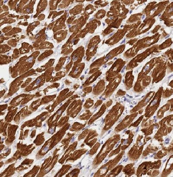 MAPRE3 Rabbit Polyclonal Antibody