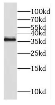 EBNA1BP2 Rabbit Polyclonal Antibody