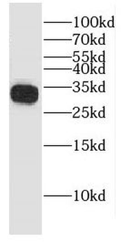 ECHS1 Rabbit Polyclonal Antibody