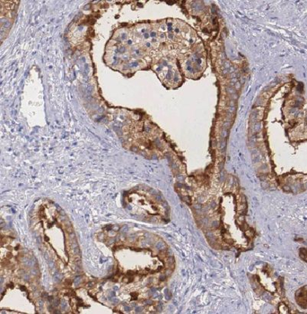 ECHS1 Rabbit Polyclonal Antibody