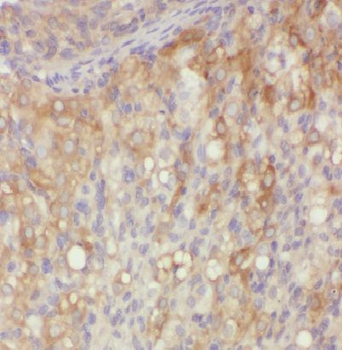VOPP1 Rabbit Polyclonal Antibody