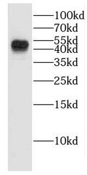 EDAR Rabbit Polyclonal Antibody