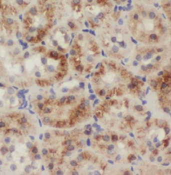 EDAR Rabbit Polyclonal Antibody