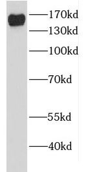 EDC4 Rabbit Polyclonal Antibody