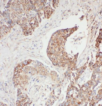 EDC4 Rabbit Polyclonal Antibody
