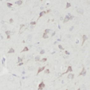 ANP32B Rabbit Polyclonal Antibody