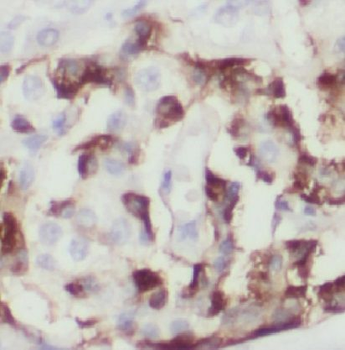 EDIL3 Rabbit Polyclonal Antibody