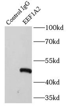 EEF1A2 Rabbit Polyclonal Antibody