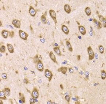 EEF1B2 Rabbit Polyclonal Antibody