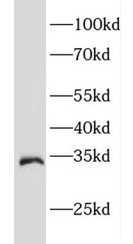 EEF1B2 Rabbit Polyclonal Antibody