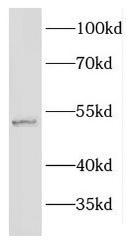 EFEMP2 Rabbit Polyclonal Antibody