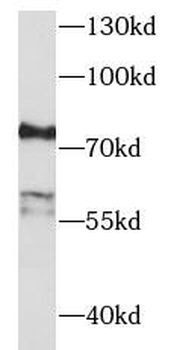 EFS Rabbit Polyclonal Antibody