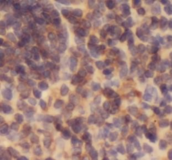EFS Rabbit Polyclonal Antibody