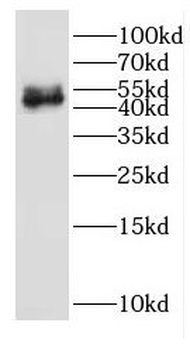 EGR2 Rabbit Polyclonal Antibody