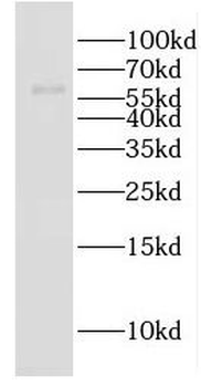 EHD2 Rabbit Polyclonal Antibody