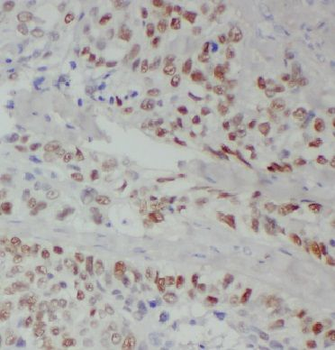 EHD2 Rabbit Polyclonal Antibody
