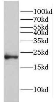 EID1 Rabbit Polyclonal Antibody