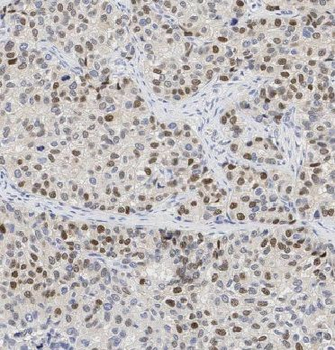EID1 Rabbit Polyclonal Antibody