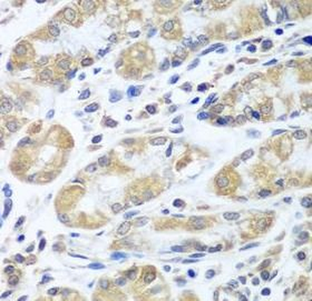 EIF1AX Rabbit Polyclonal Antibody