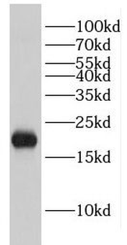 EIF1AX Rabbit Polyclonal Antibody