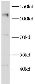 EIF3B Rabbit Polyclonal Antibody