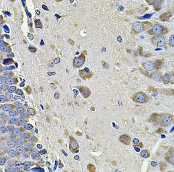 EIF3C Rabbit Polyclonal Antibody