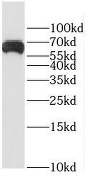 EIF3D Rabbit Polyclonal Antibody