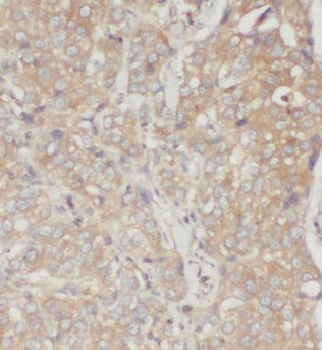 EIF3D Rabbit Polyclonal Antibody