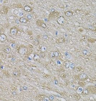 EIF3H Rabbit Polyclonal Antibody