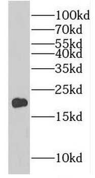 EIF4EBP2 Rabbit Polyclonal Antibody