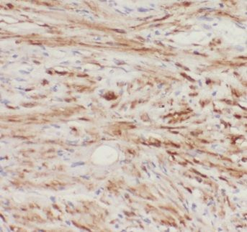 EIF4EBP2 Rabbit Polyclonal Antibody