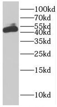 EIF5 Rabbit Polyclonal Antibody