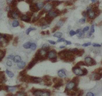EIF5 Rabbit Polyclonal Antibody