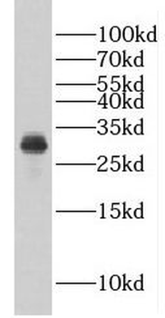 Eif6 Rabbit Polyclonal Antibody