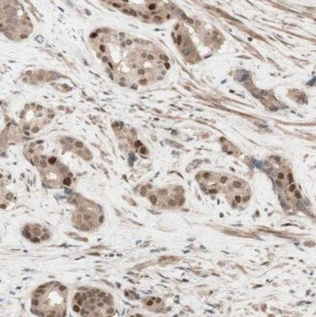 Eif6 Rabbit Polyclonal Antibody
