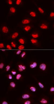 ELK1 Rabbit Polyclonal Antibody