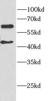 ELK1 Rabbit Polyclonal Antibody