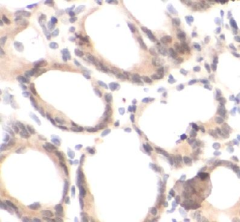 ELK1 Rabbit Polyclonal Antibody