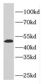 ELK4 Rabbit Polyclonal Antibody