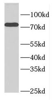 ELL Rabbit Polyclonal Antibody