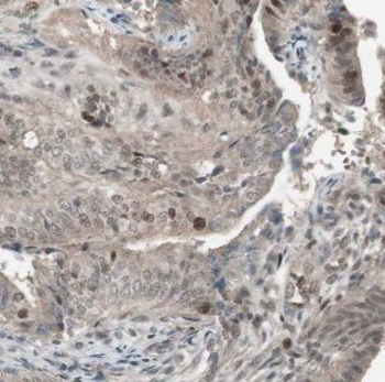 ELL Rabbit Polyclonal Antibody