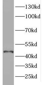 ELOVL6 Rabbit Polyclonal Antibody