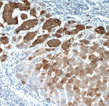 ELOVL6 Rabbit Polyclonal Antibody