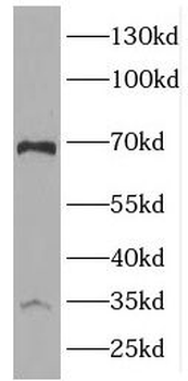 AIMP1 Rabbit Polyclonal Antibody