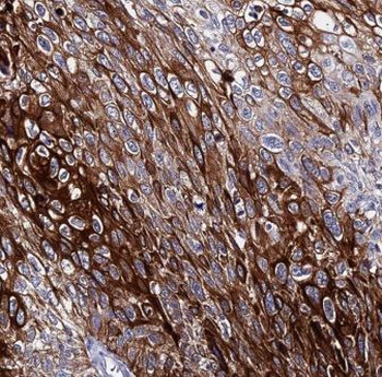 AIMP1 Rabbit Polyclonal Antibody
