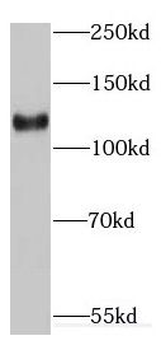 EMILIN1 Rabbit Polyclonal Antibody