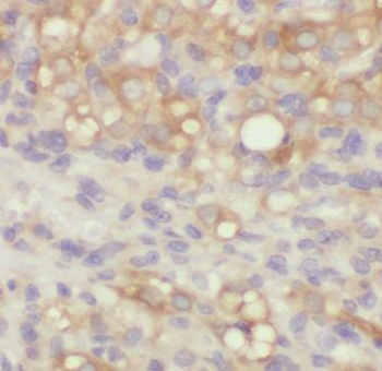EMILIN1 Rabbit Polyclonal Antibody